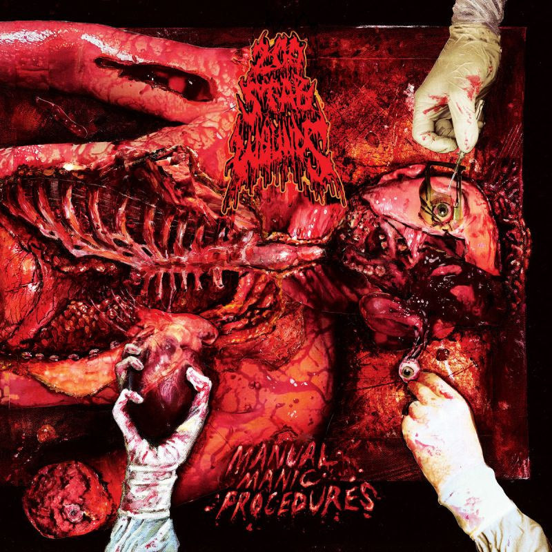 200 Stab Wounds - Manual manic procedures (LP)