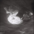 Alice Phoebe Lou - Glow (CD) - Velvet Music